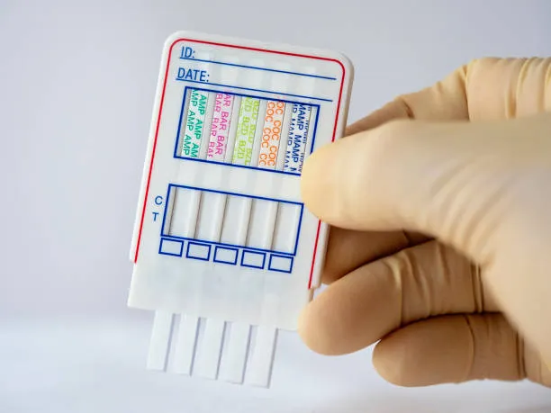 Mobile drug test collection supplies ready for a workplace visit